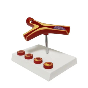 Damar Tıkanıklığı Maketi