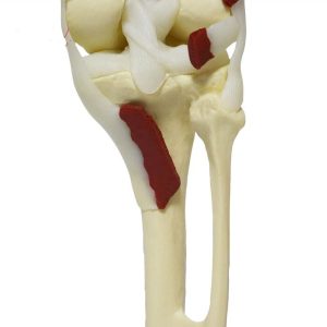 Kaslı diz maketi Model 31